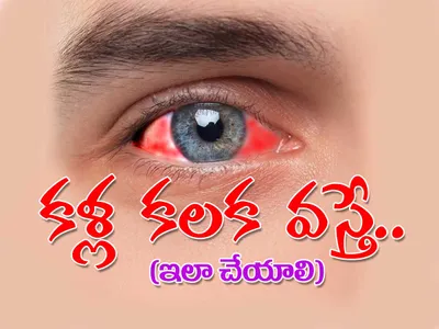 కళ్ల కలక వస్తే   ఇలా చేయండి 